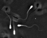 cropped-bull-sperm5.jpg